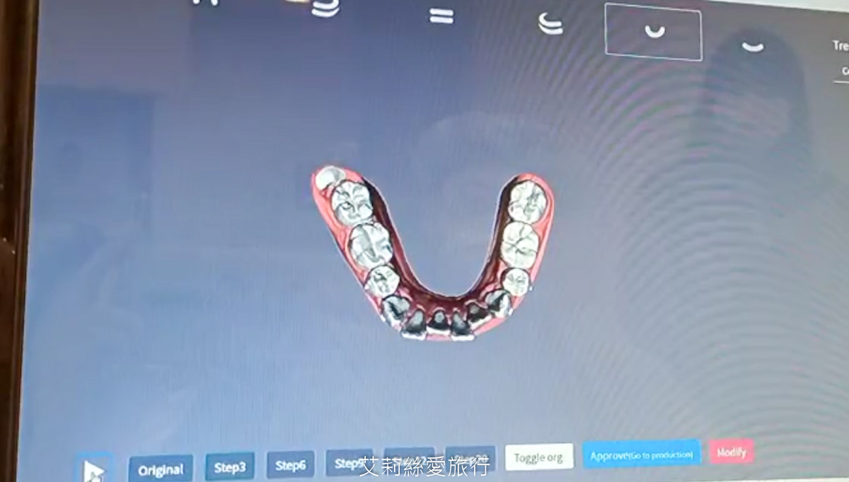 YA!SMILE隱形牙套數位口掃