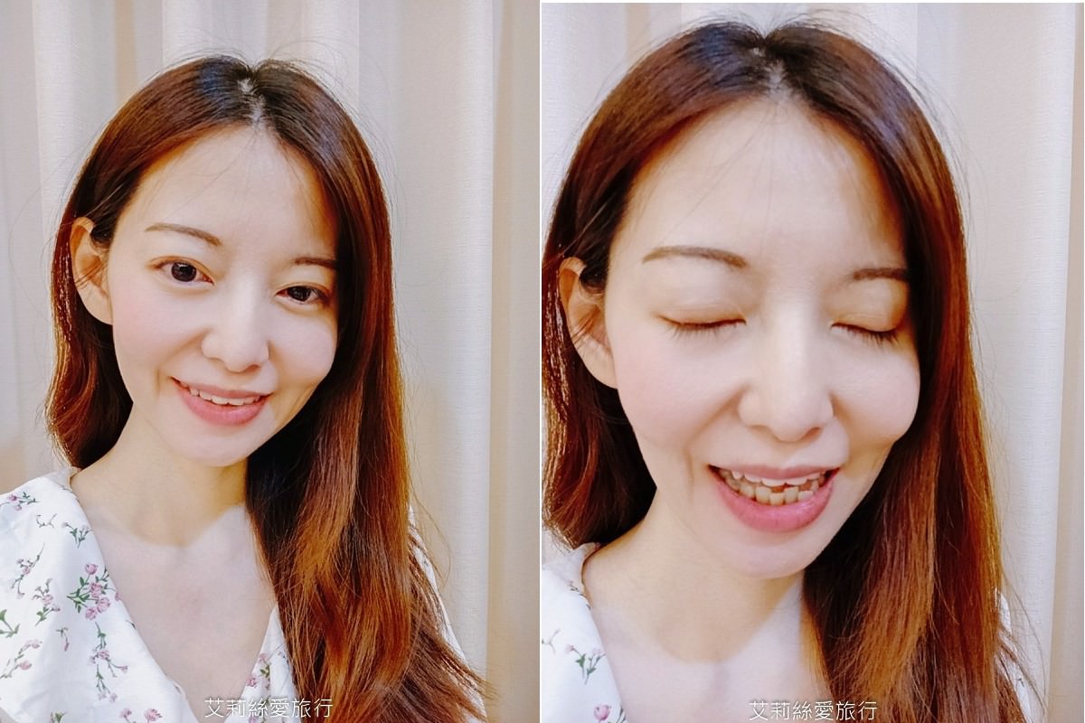 YA!SMILE隱形牙套諮詢幫助改善下排牙齒不整