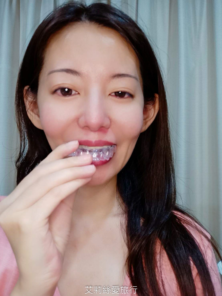 YA!SMILE隱形牙套心得