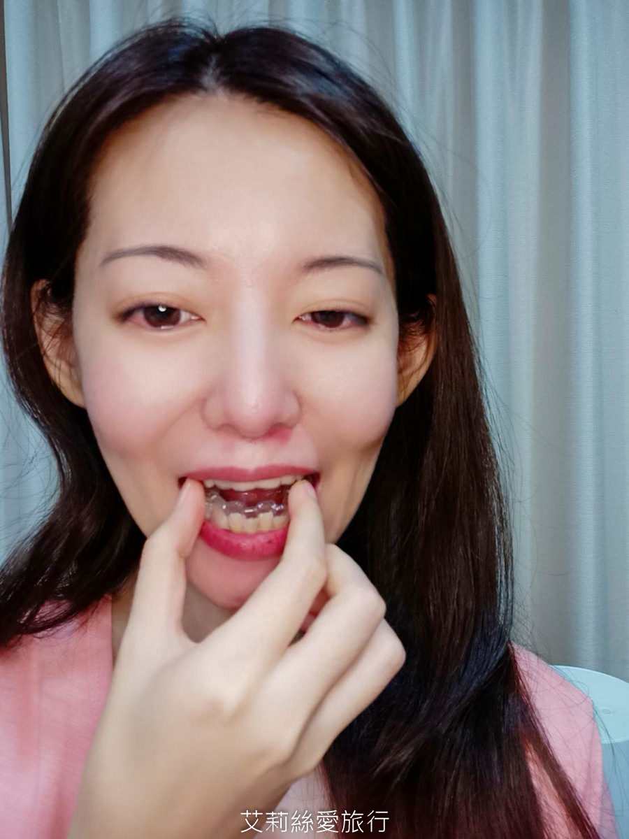YA!SMILE隱形牙套好好戴