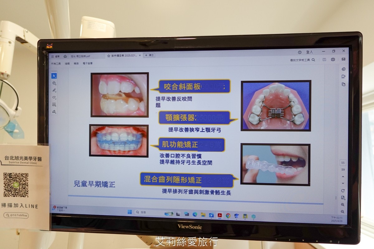 台北旭光牙醫 隱適美諮詢分享 服務親切 價格透明 小朋友放鬆不害怕看牙醫 - 第14張圖 台北旭光牙醫 隱適美諮詢分享 服務親切 價格透明 小朋友放鬆不害怕看牙醫