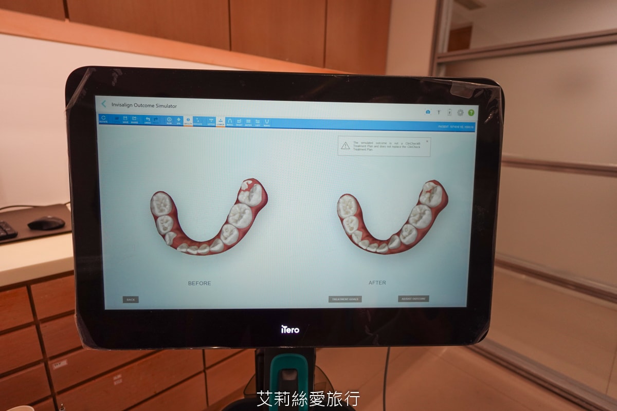 台北旭光牙醫 隱適美諮詢分享 服務親切 價格透明 小朋友放鬆不害怕看牙醫 - 第19張圖 台北旭光牙醫 隱適美諮詢分享 服務親切 價格透明 小朋友放鬆不害怕看牙醫