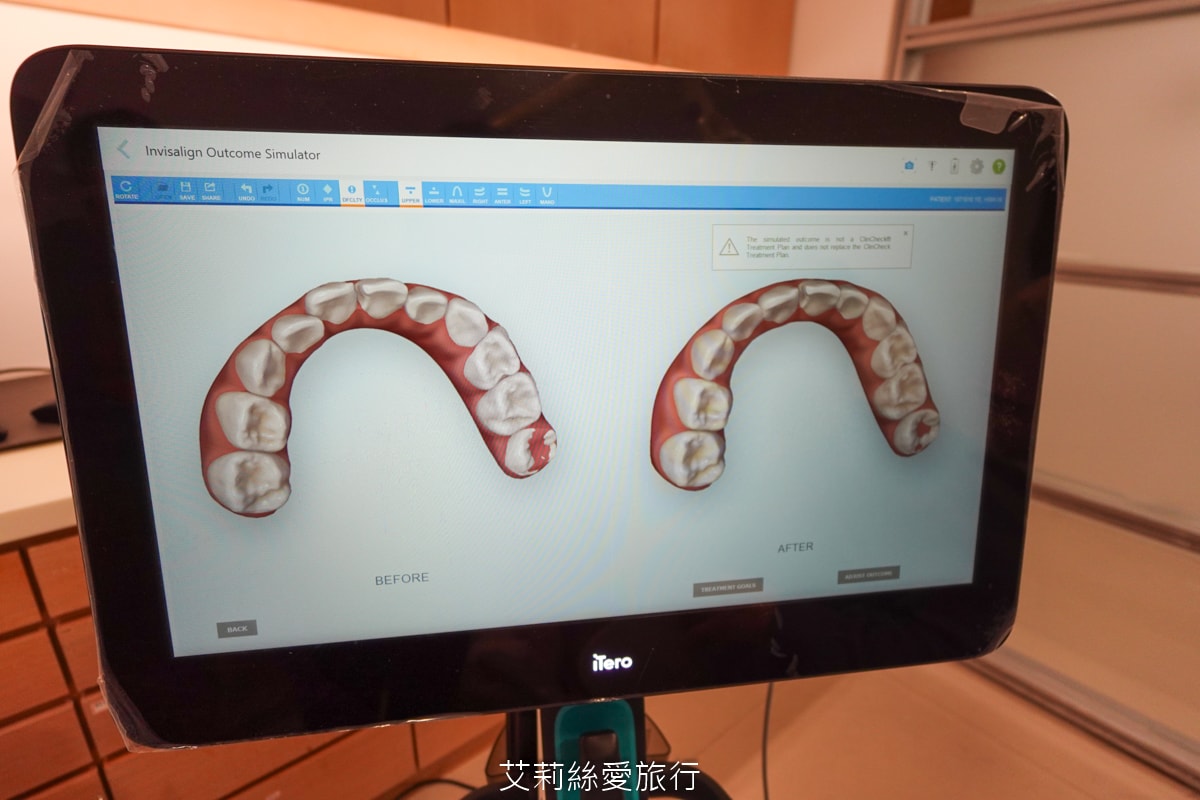 台北旭光牙醫 隱適美諮詢分享 服務親切 價格透明 小朋友放鬆不害怕看牙醫 - 第20張圖 台北旭光牙醫 隱適美諮詢分享 服務親切 價格透明 小朋友放鬆不害怕看牙醫