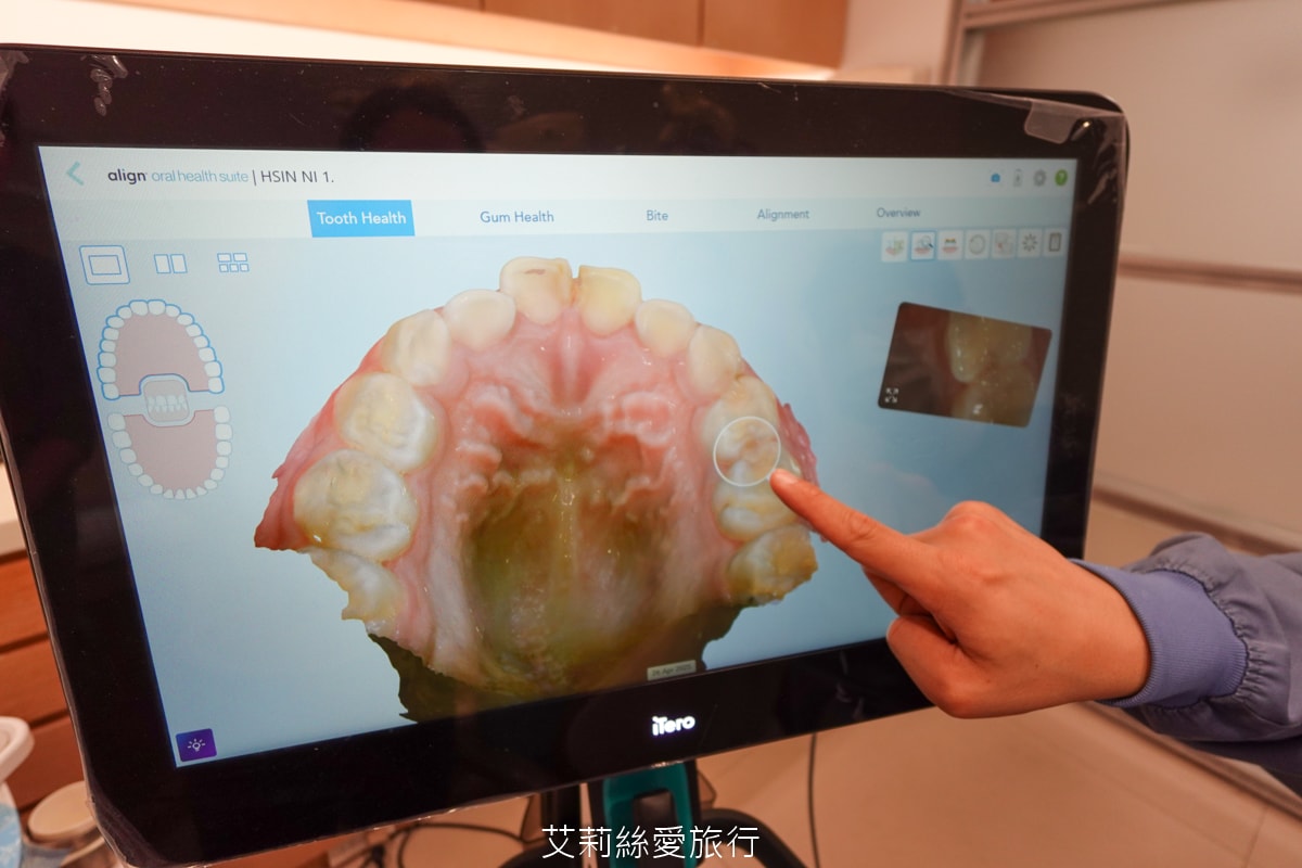 台北旭光牙醫 隱適美諮詢分享 服務親切 價格透明 小朋友放鬆不害怕看牙醫 - 第22張圖 台北旭光牙醫 隱適美諮詢分享 服務親切 價格透明 小朋友放鬆不害怕看牙醫