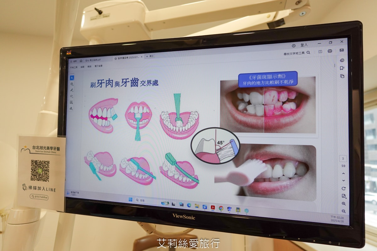 台北旭光牙醫 隱適美諮詢分享 服務親切 價格透明 小朋友放鬆不害怕看牙醫 - 第8張圖 台北旭光牙醫 隱適美諮詢分享 服務親切 價格透明 小朋友放鬆不害怕看牙醫